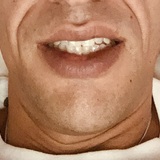 Morais20cm