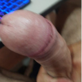 PROCURO